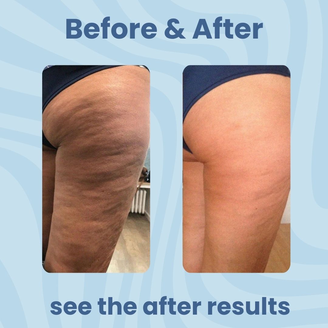 Svarna™- CelluGlow Roller