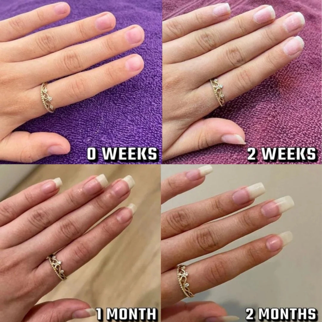 Svarna™- Nail Growth Pen