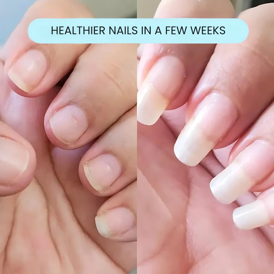 Svarna™- Nail Growth Pen