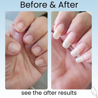 Svarna™- Nail Growth Pen
